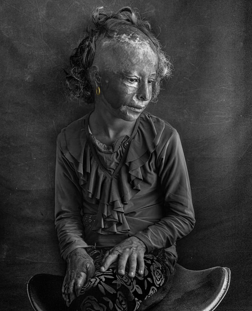 Pensive Young Girl by Abbas Arabzadeh — canvas wall art