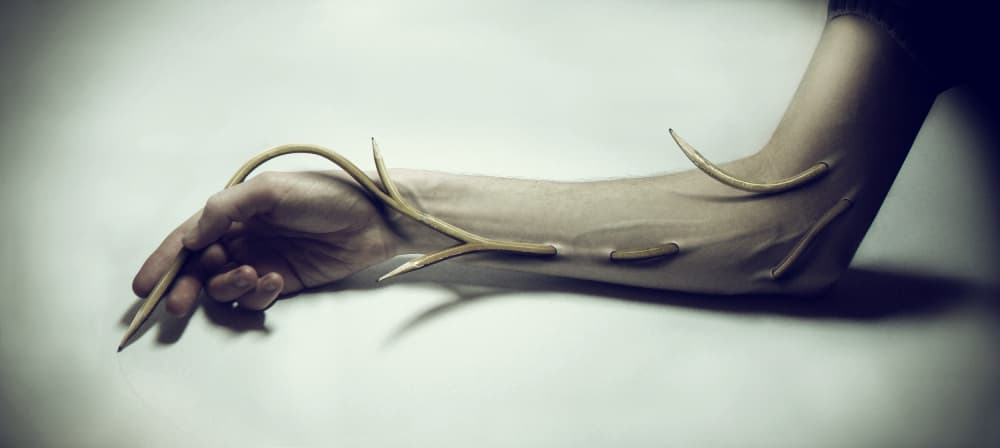 Surreal Arm Growth by Andrii Vasyliev — canvas wall art