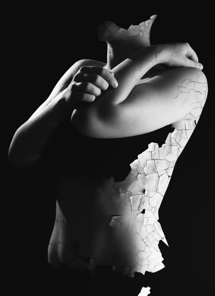 Cracked Skin Torso by Elior Segev — canvas wall art