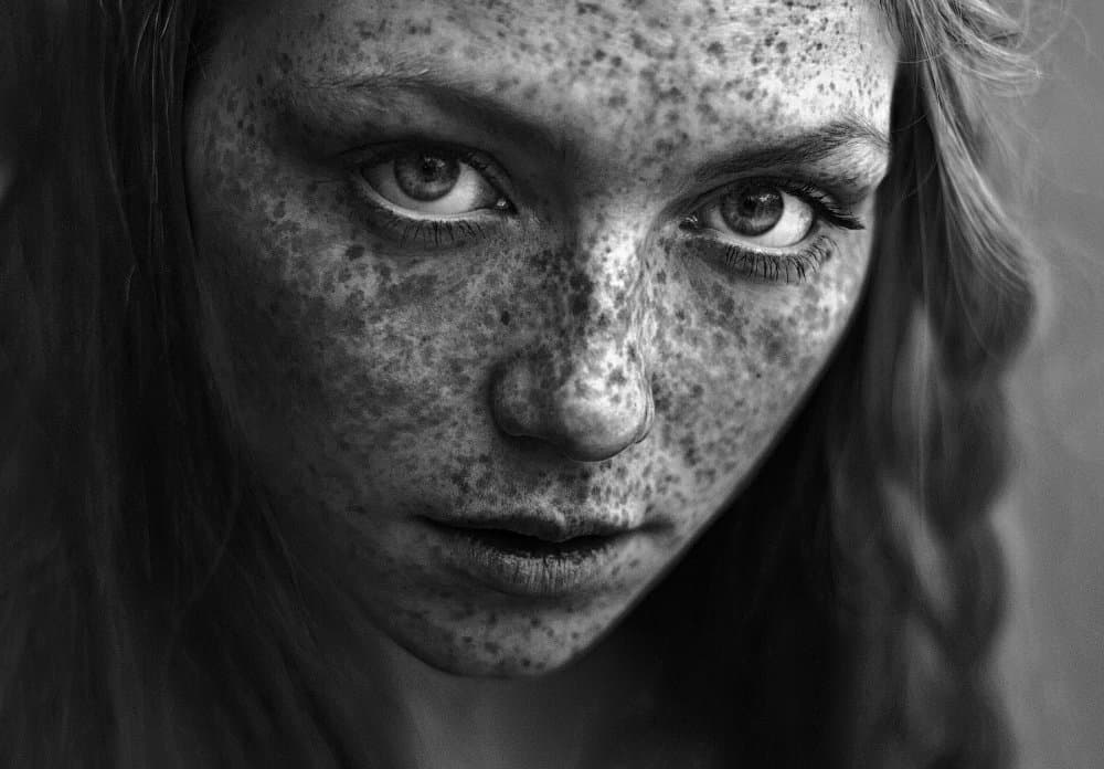 Striking Freckled Face by Irina Bunyatyan — canvas wall art