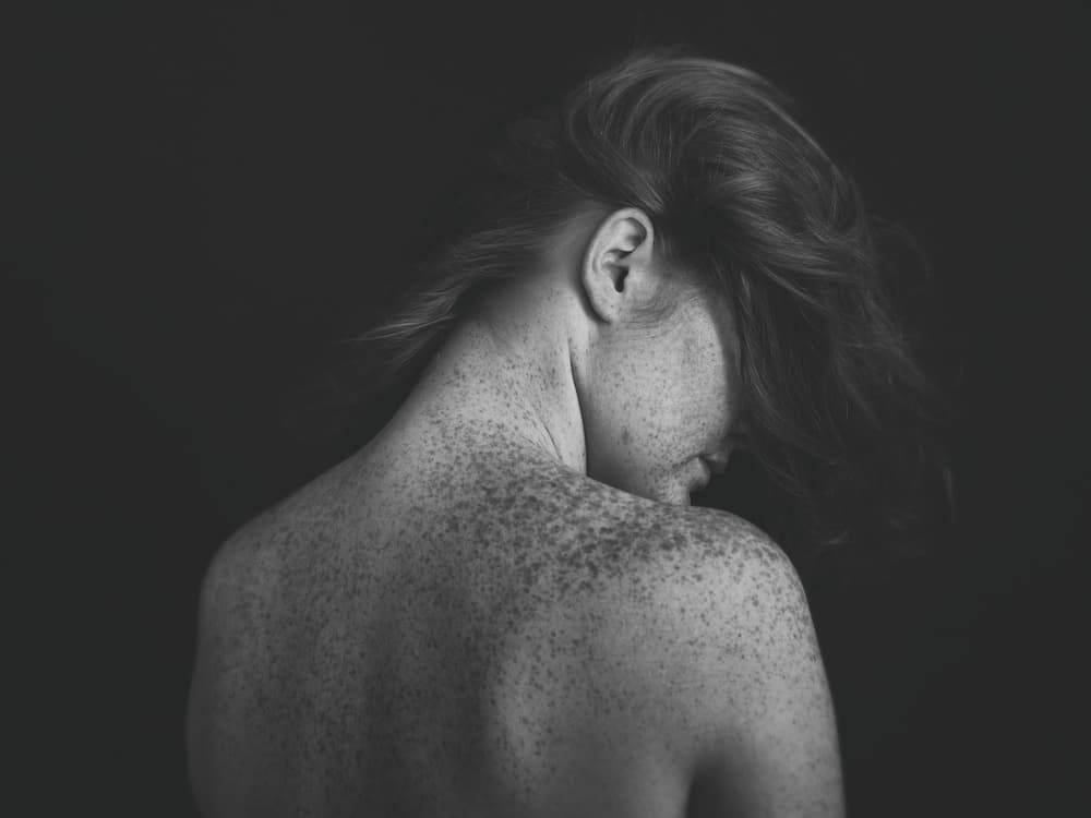 Freckled Skin Portrait by Martina Nemcekova EP — canvas wall art