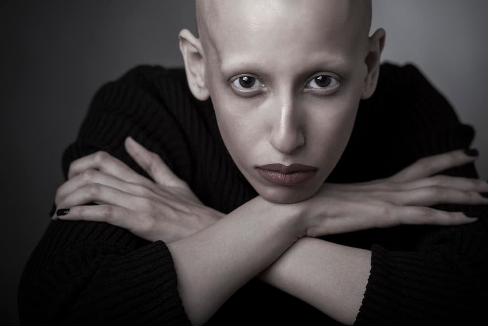 Bald Woman's Intense Gaze by Hamed Khosroshahi — canvas wall art