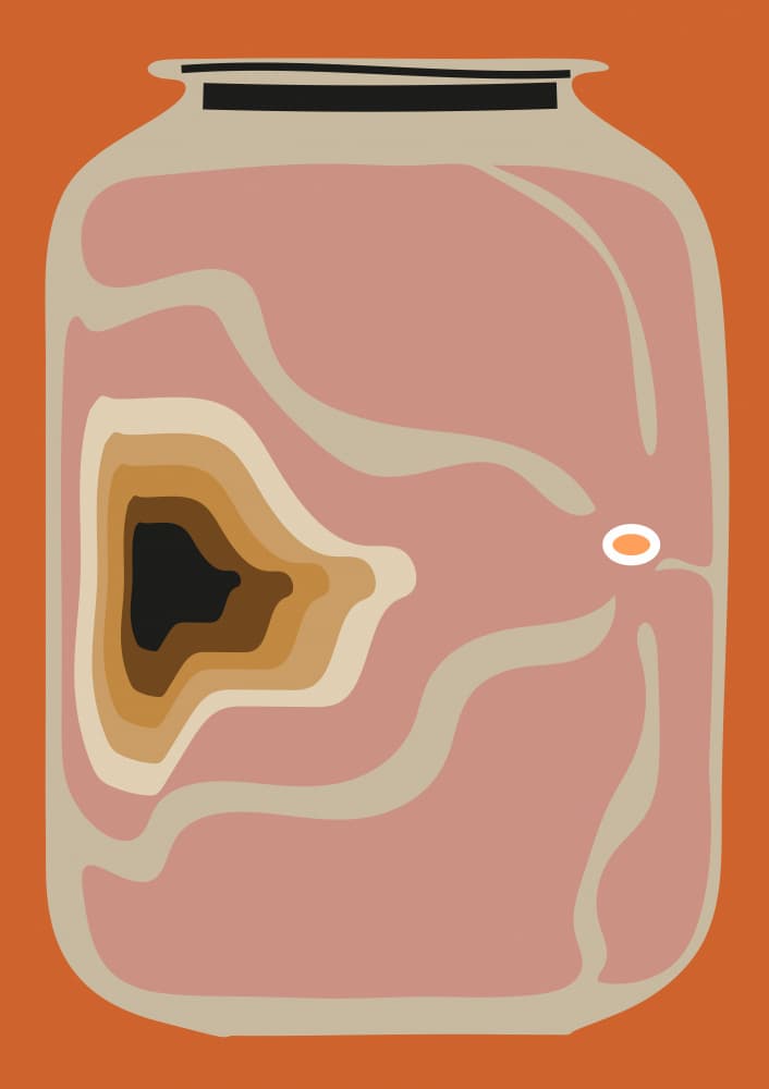 Wound In A Jar by Frances Collett — canvas wall art