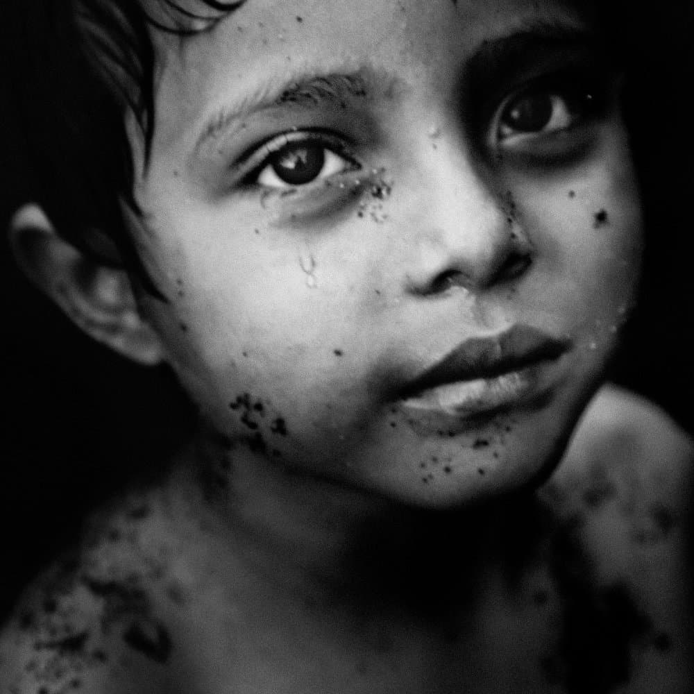 Crying Child's Face by txules — canvas wall art