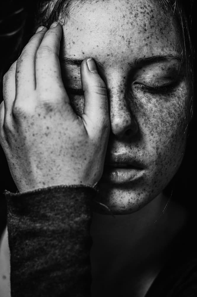 Pensive Freckled Face