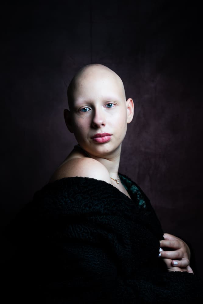 Serene Bald Gaze by Christian Kurz — canvas wall art