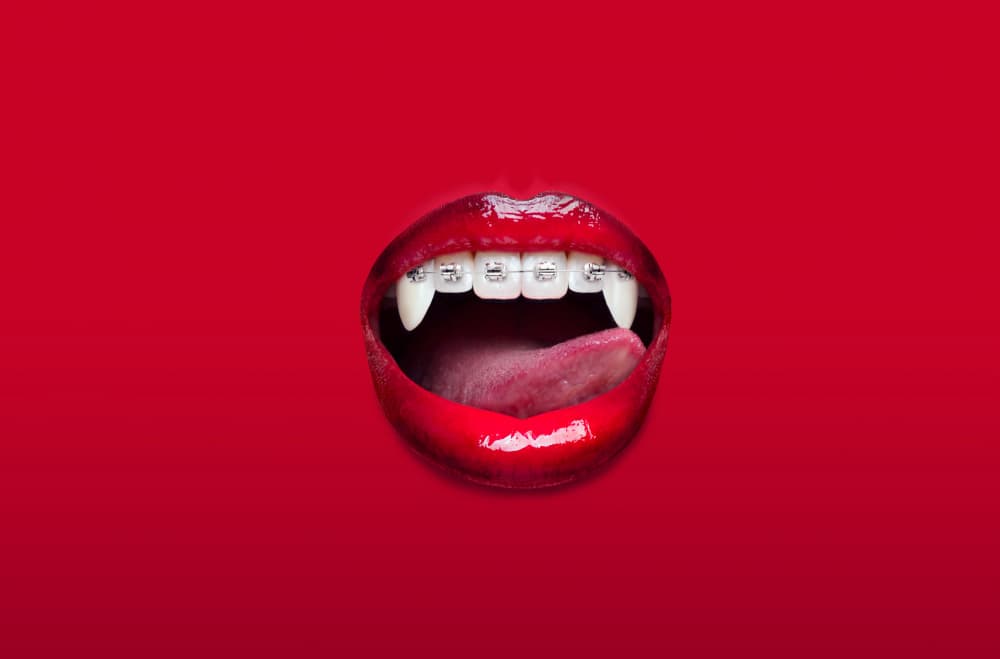 Red Vampire Lips Braces by Artem Pozdniakov — canvas wall art