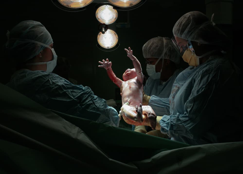 Miracle of Birth by Tomasz Solinski — canvas wall art
