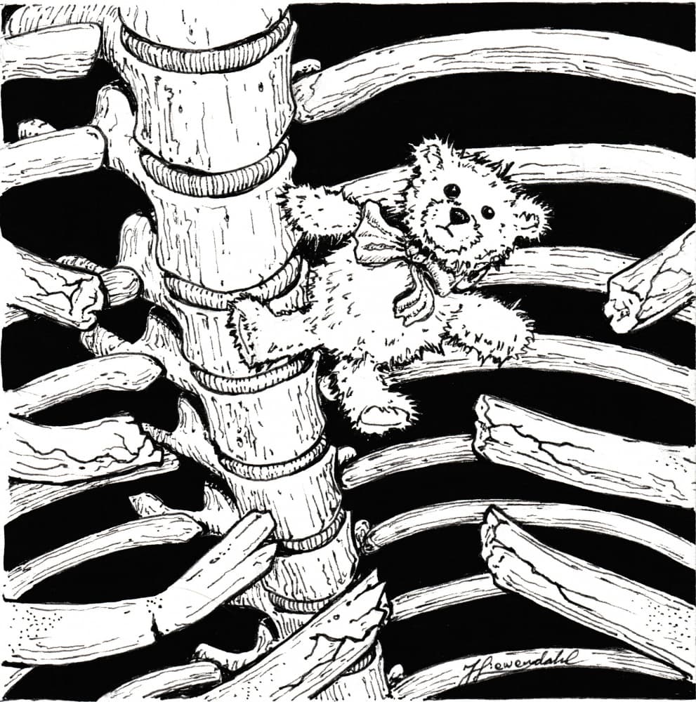 Skeletal Teddy Bear by Johan Liewendahl — canvas wall art