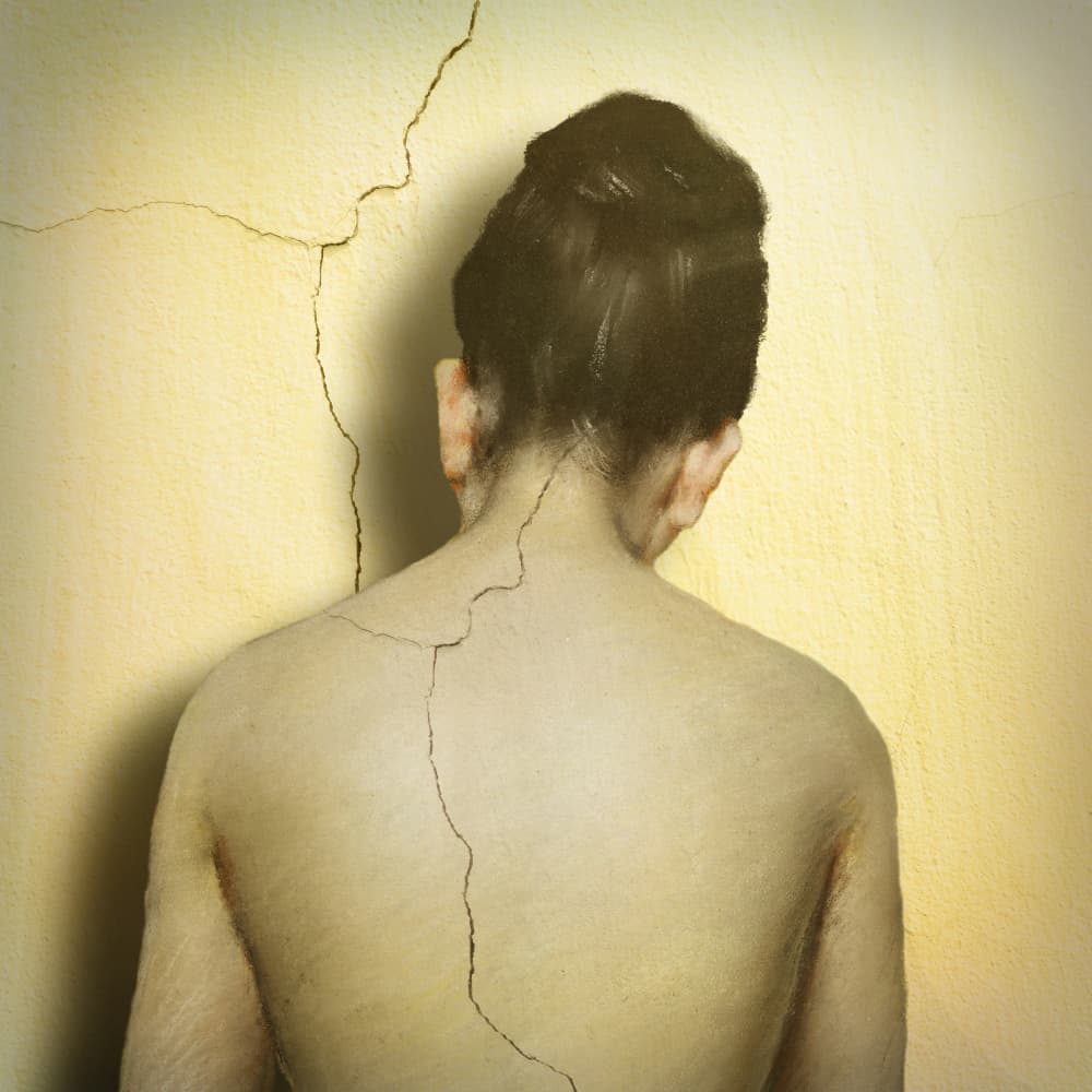 Cracked Back Vulnerability by Marja van den Hurk — canvas wall art