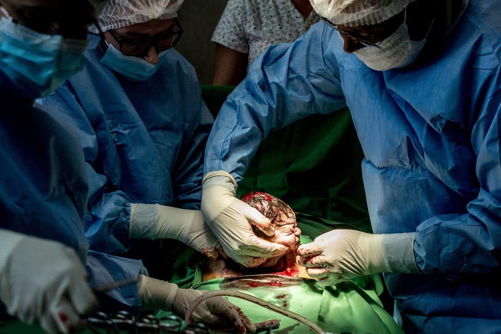 Newborn C-Section Delivery by Ovi D. Pop — canvas wall art