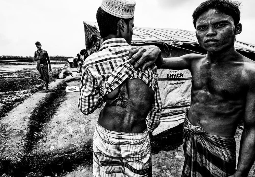 Refugee Man's Scars by Joxe Inazio Kuesta Garmendia — canvas wall art
