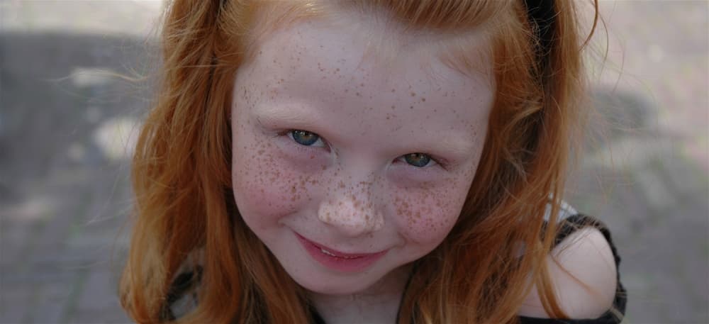 Sweet Freckled Smile by Huib Limberg — canvas wall art