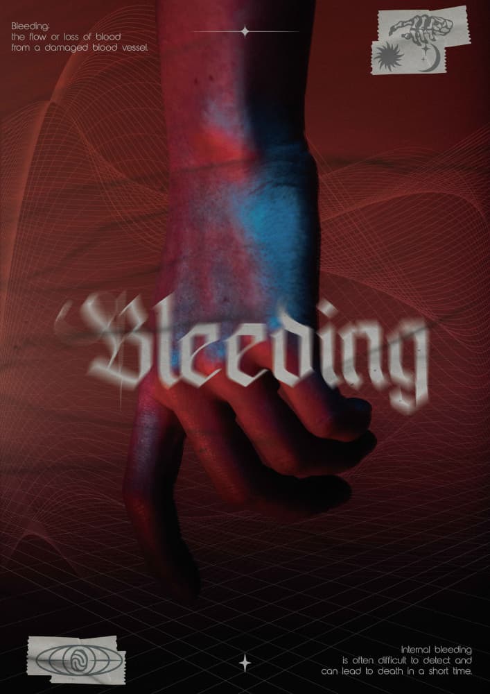 Gothic Bleeding Hand by Omar ELMOUDDEN — canvas wall art