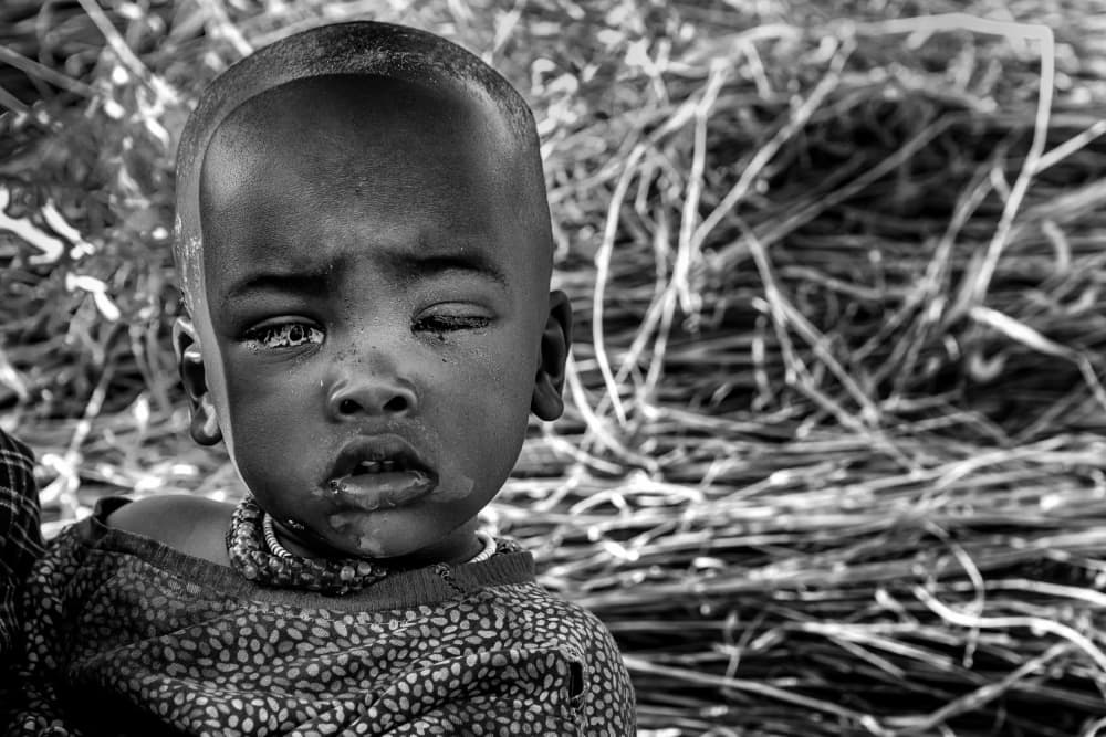 Sad African Child by Giuseppe DAmico — canvas wall art