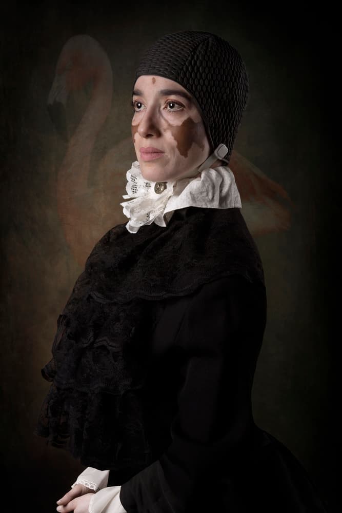 Classic Portrait Vitiligo Woman by Carola Kayen-Mouthaan — canvas wall art