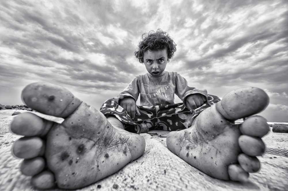 Intense Child Barefoot by Emir Bagci — canvas wall art