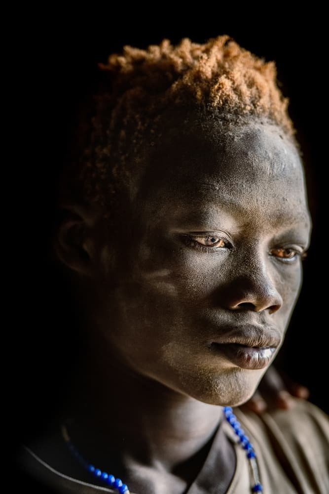 Striking Albino Youth by Trevor Cole — canvas wall art