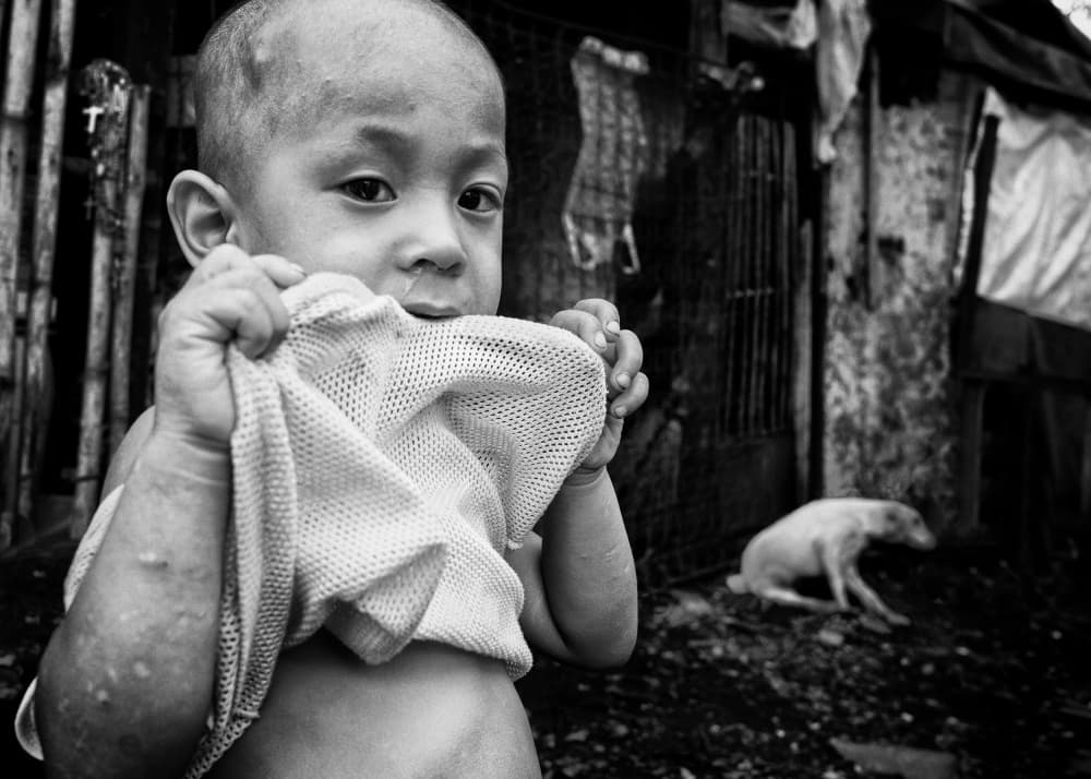 Child In Urban Slum by Shinji Isobe — canvas wall art