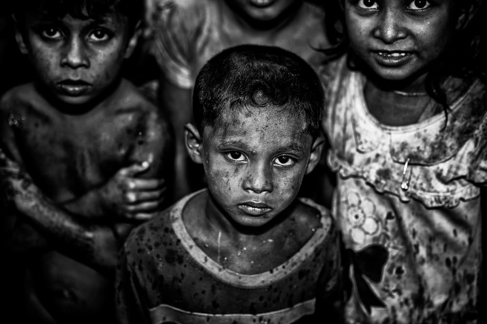 Rohingya children in the rain. by Joxe Inazio Kuesta Garmendia — canvas wall art