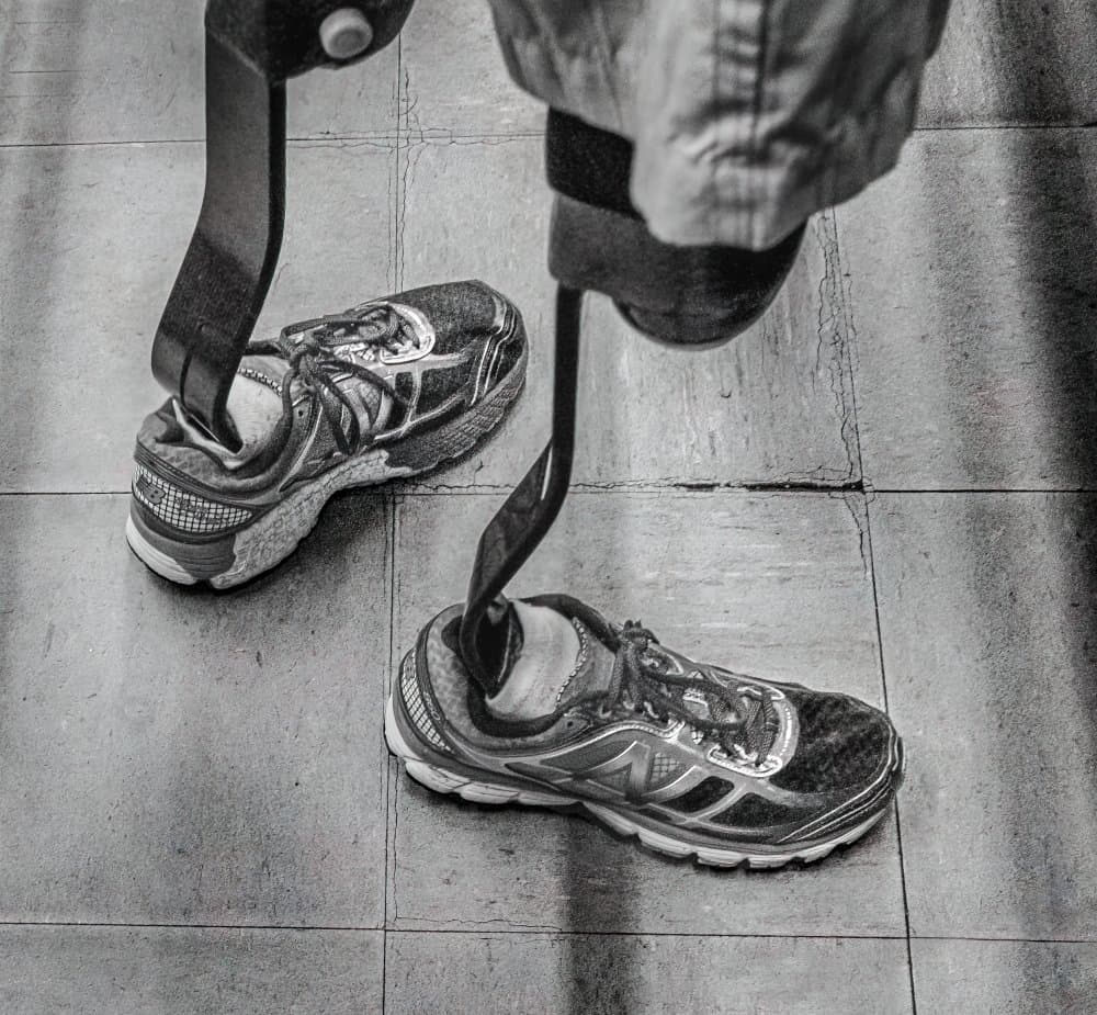 Resilient Prosthetic Steps by Kirk Cypel — canvas wall art