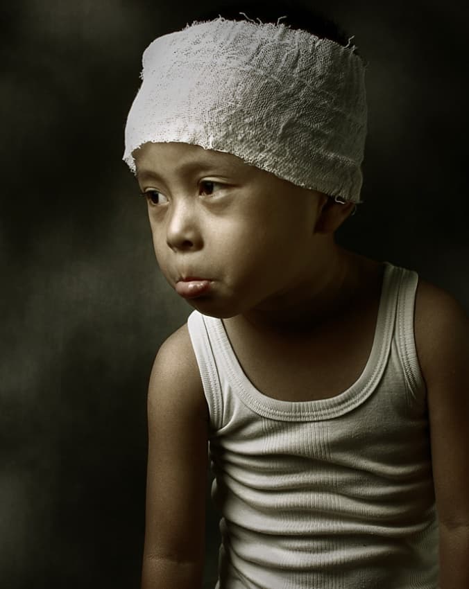 Sad Boy With Bandage by Hari Sulistiawan — canvas wall art
