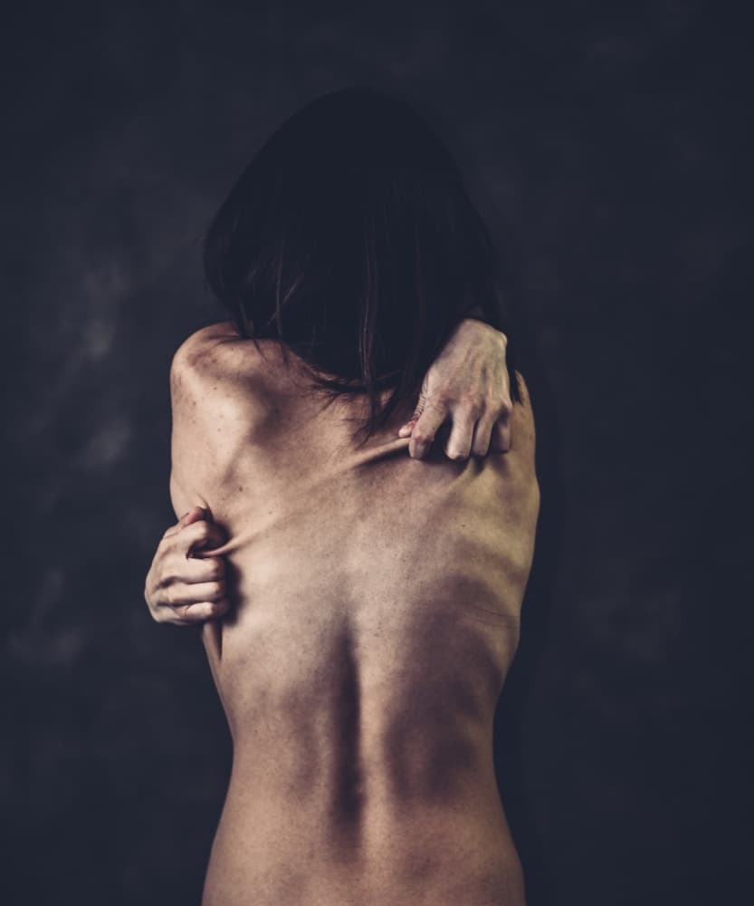 The Fragile Back by Koki Jovanovic — canvas wall art