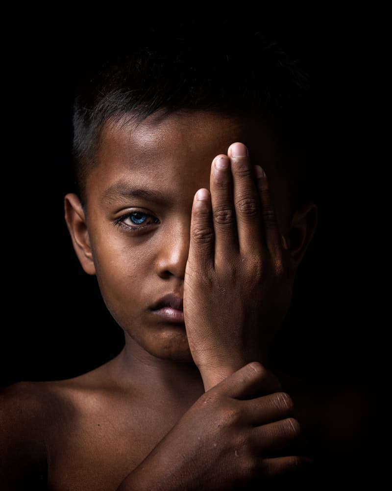 Boy with Blue Eye by Fira Mikael — canvas wall art
